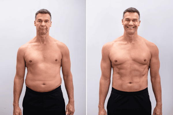 Diet, Weight Loss and Body Contouring: Understanding the Difference