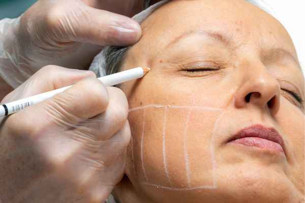 CryoPen: 5 Skin Concerns It May Be Used to Treat 4 What should you ask before having CryoPen treatment Dartford?