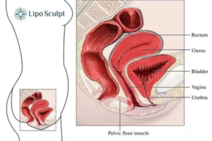 Treatment For A Leaky Bladder 2 How EM Chair treatment Dartford can help Leaky bladder issues. Read more now!