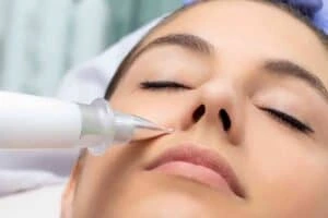 Best Actinic Keratoses Removal 3 Actinic keratoses Dartford solutions - book in today!