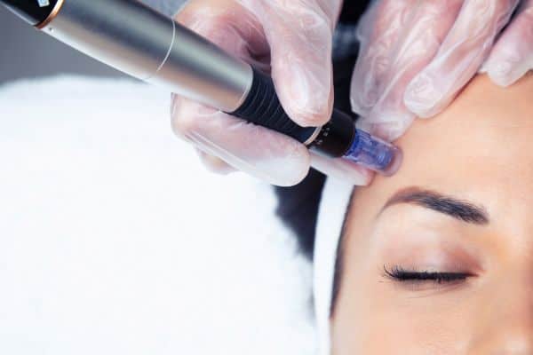 What Skin Concerns Can Total Skin Tightening Treatment Help With Dartford?