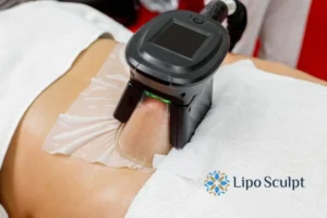 Does Fat Freezing At Home Work? 3 Fat freezing at home from Lipo Sculpt Dartford